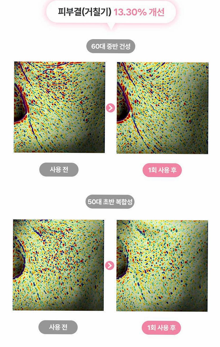 펄리 엑소좀 피부과재생크림 수분 보습 시카 히알루론산 물광크림 40ml, 1개